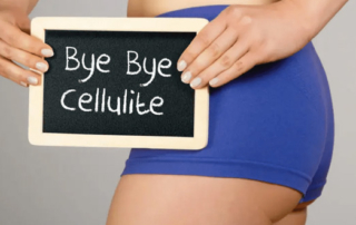 treat-cellulite